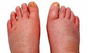 اگر این علائم را دارید حتما در معرض یک بیماری جدی هستید!