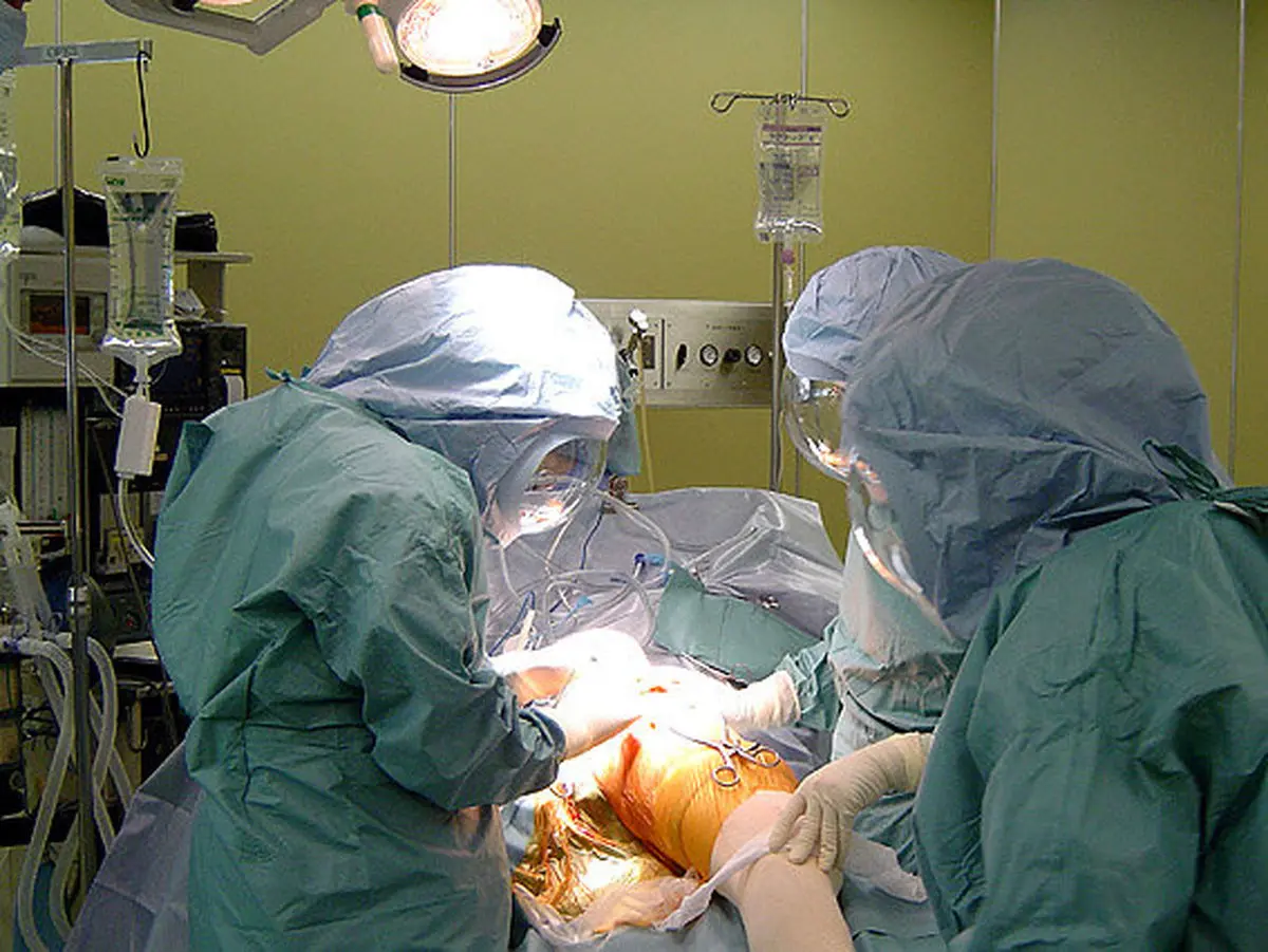 پیوند موفقیت‌آمیز دست قطع‌ شده‌ یک جوانی در یزد