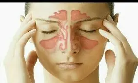 ادویه مناسب جهت باز کردن سینوس ها