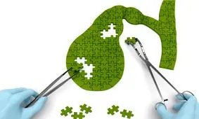 زندگی بدون کیسه صفرا