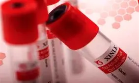 عضویت فرد خون گیرنده مدرسه تاکستان در هلال احمر تکذیب شد