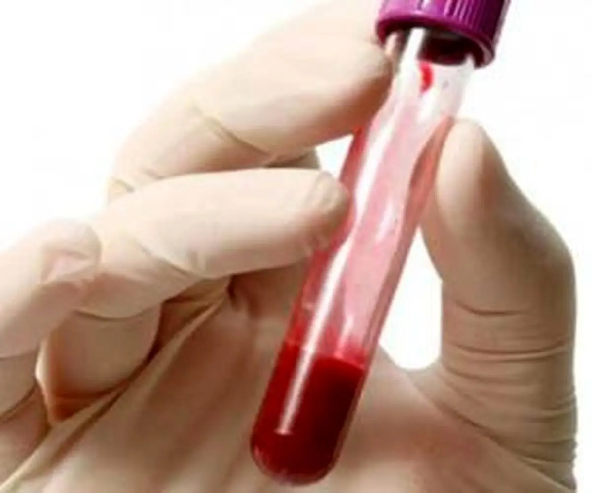 بازداشت عامل خون گیری مدرسه دخترانه