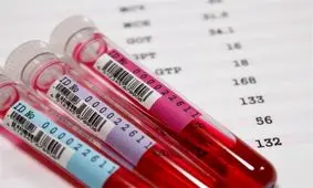 انگیزه عامل خونگیری مدرسه تاکستان احتمالاً عاشقانه بوده است/ مدیر و ناظم مدرسه اهمال کردند