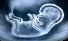 با کاربرد‌ها و خطرات آزمایش سونوگرافی آشنا شوید