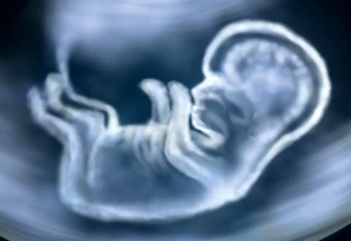 با کاربرد‌ها و خطرات آزمایش سونوگرافی آشنا شوید