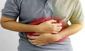 مصرف قلیان و سیگار عوامل شایع رفلاکس معده