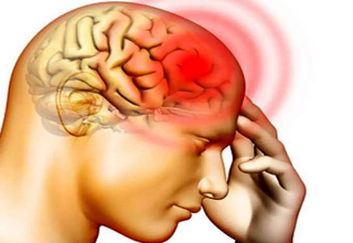 ۸ عامل سردرد که شاید دور از ذهن باشند!