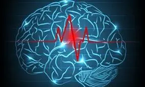 نکاتی که افراد مبتلا به صرع قبل از بارداری باید بدانند