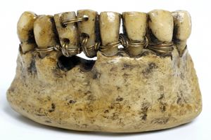 سیم کشی دندان مردگان در مصر باستان!