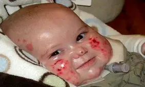 میراثی نهفته در ژن که زندگی را کام انسان تلخ می‌کند!