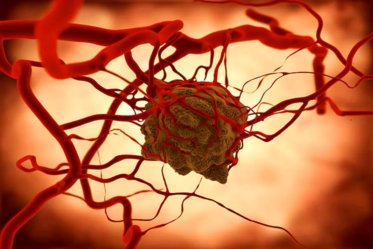 آیا داروی گیاهی به تنهایی در درمان سرطان موثر است؟