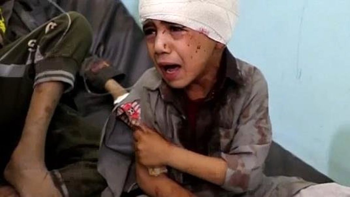کشته شدن 15 غیرنظامی در حمله ائتلاف سعودی به دو اتوبوس در غرب یمن
