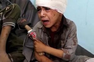 کشته شدن 15 غیرنظامی در حمله ائتلاف سعودی به دو اتوبوس در غرب یمن