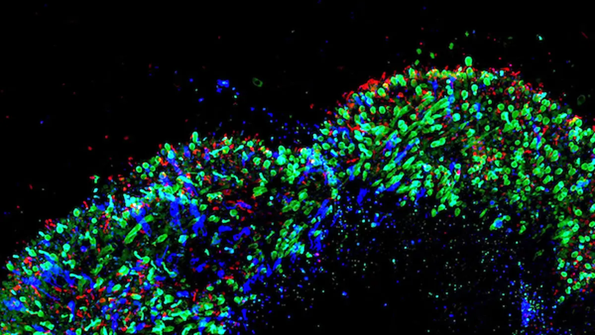 پرورش چشم در آزمایشگاه و امیدهای تازه برای درمان کوررنگی