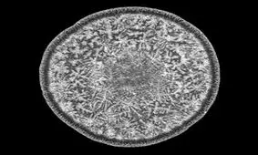 قطره اشک انسان را زیر میکروسکوپ ببینید