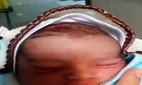 تیغ جراحی پیشانی نوزاد سزارینی را شکافت