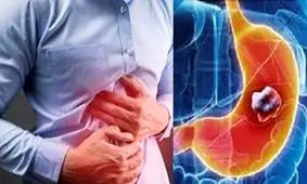 رژیم غذایی برای درمان رفلاکس