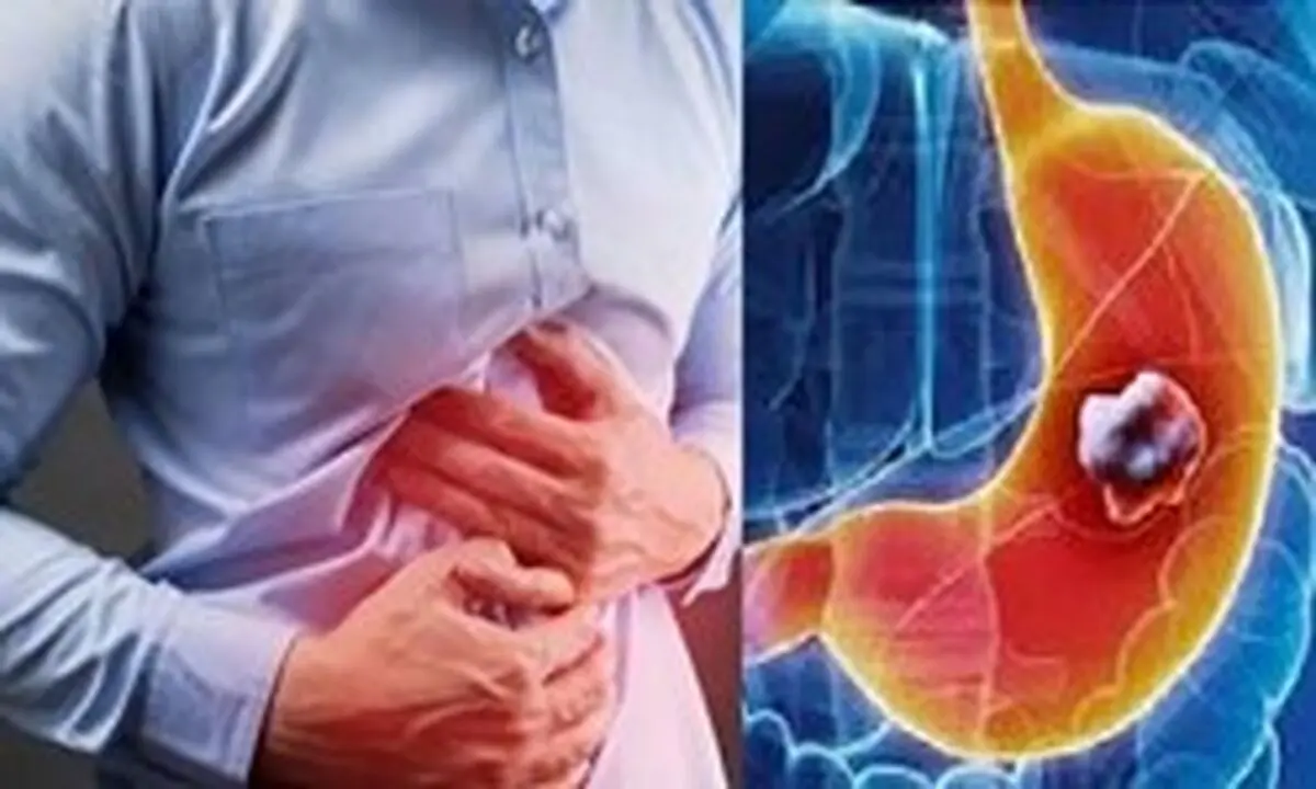 رژیم غذایی برای درمان رفلاکس
