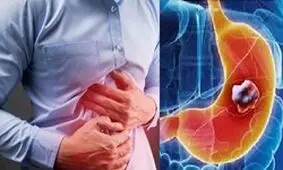 رژیم غذایی برای درمان رفلاکس