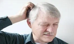 علل خارش پوست سر چیست؟