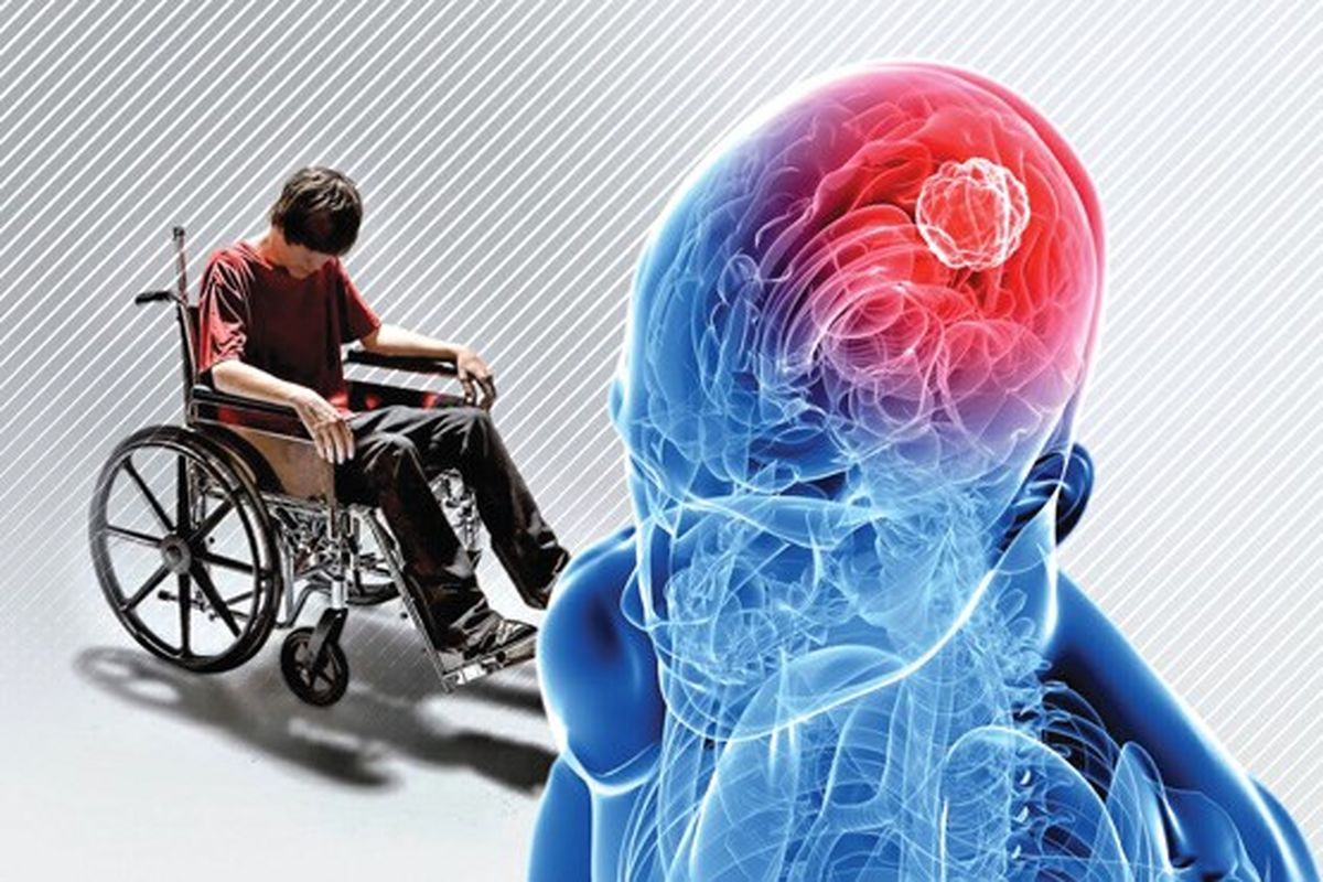 مبتلایان به بیماری ام اس چی بخورند؟