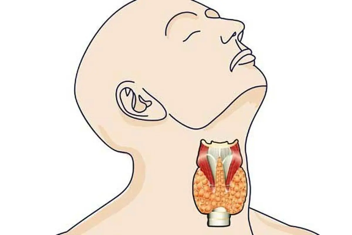 عاداتی که سلامت تیروئید را به خطر می‌اندازد