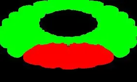 جوابیه شهرداری قزوین درباره مصدومیت خبرنگار صداوسیما