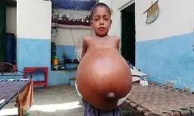 بیماری عجیب پسر ۹ ساله +عکس