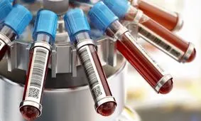 اجتناب از شیمی درمانی غیرضروری با یک آزمایش!