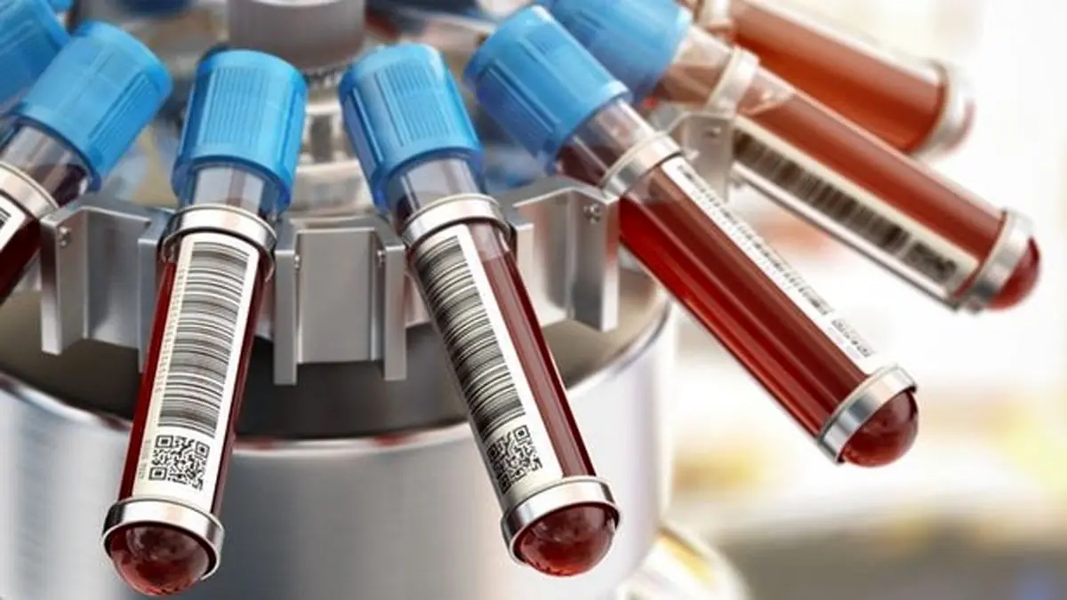 اجتناب از شیمی درمانی غیرضروری با یک آزمایش!