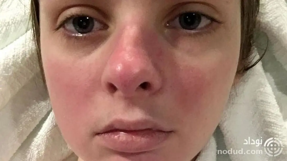 بیماری عجیب این دختر 21 ساله او را به این روز انداخته ! + عکس