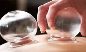 حجامت برای چه کسانی مضر است؟