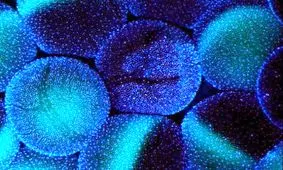 کشف ماده ای که تاثیر مهمی در سلامت مغز دارد