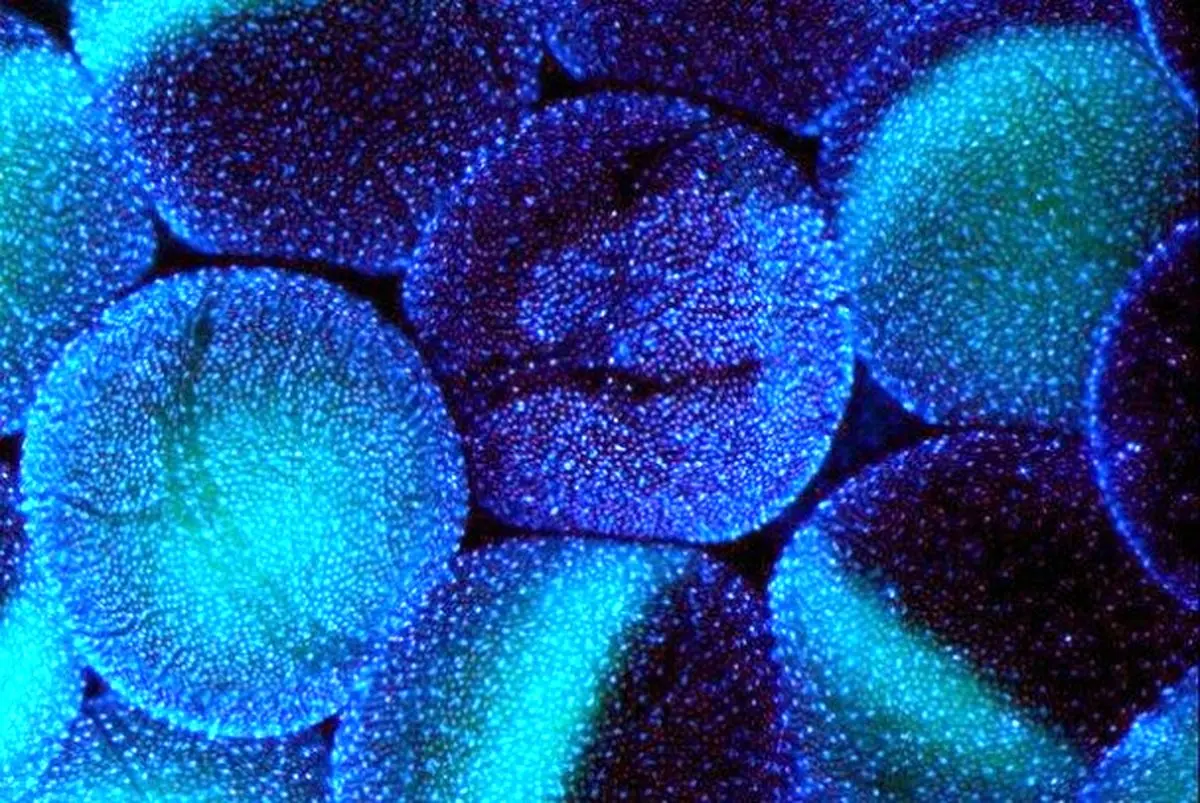 کشف ماده ای که تاثیر مهمی در سلامت مغز دارد