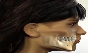 فیلمی جالب از معرفی انواع جراحی فک