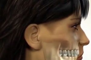 فیلمی جالب از معرفی انواع جراحی فک