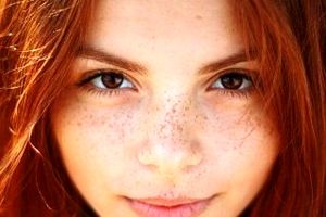 7 درمان طبیعی برای نقاط تیره روی پوست