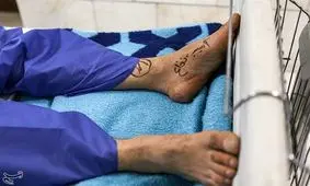 یک کمبود جدید پزشکی / دررفتگی که می‌تواند ۱۰۰ بار رخ دهد