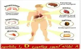 8 نشانه ی کمبود ویتامین D را بدانید