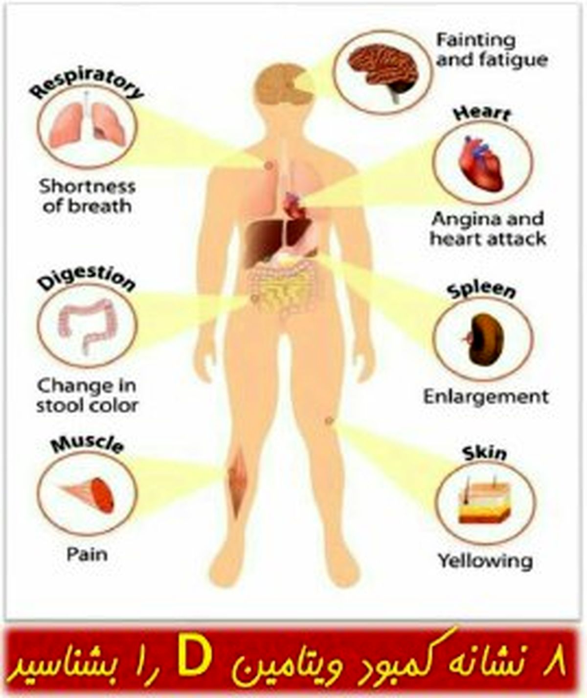 8 نشانه ی کمبود ویتامین D را بدانید