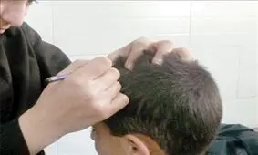یک نسخه ساده گیاهی برای از بین بردن قطعی "شپش" سر