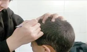 یک نسخه ساده گیاهی برای از بین بردن قطعی "شپش" سر