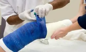 انحراف شصت پا در زنان شایع تر است/استفاده از کفش مناسب