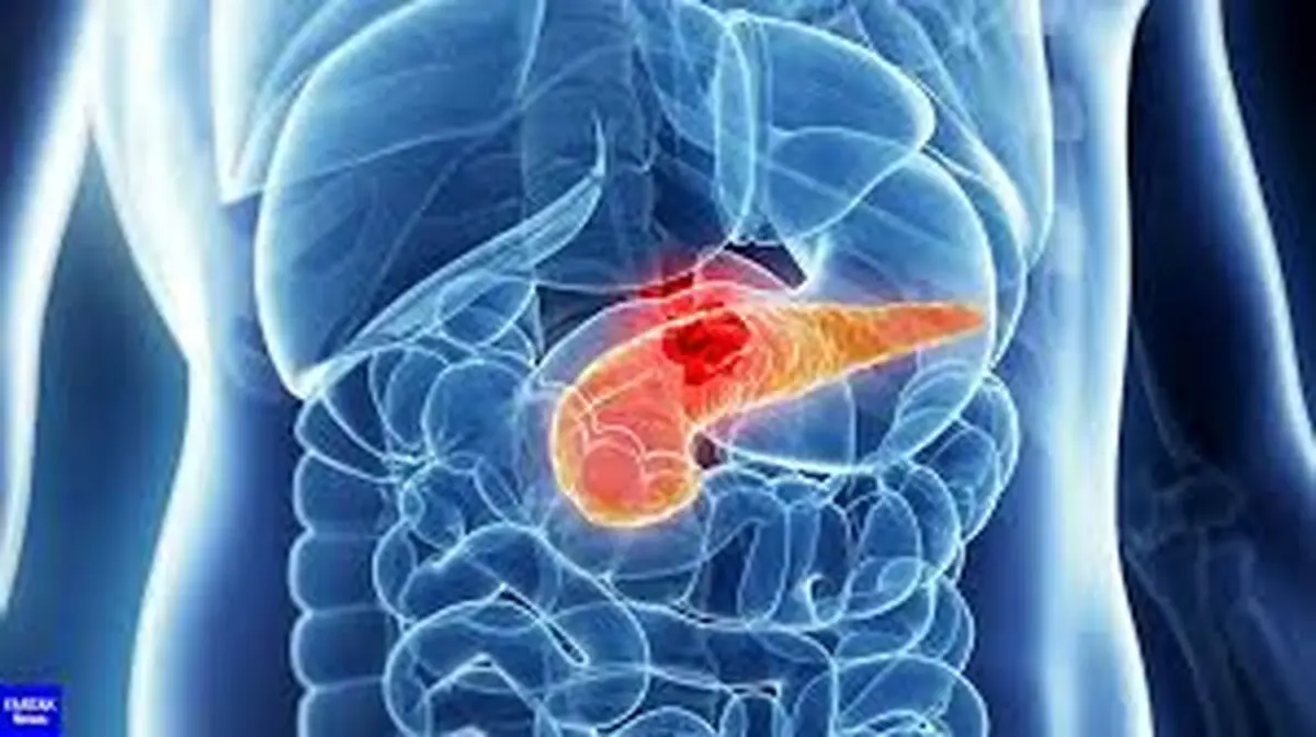 چگونه ویتامین B12، پانکراتیت حاد را درمان می‌کند؟/ ویدئو