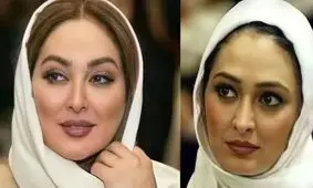 تاثیر شگرف عمل زیبایی و کاهش وزن روی بازیگران ایرانی