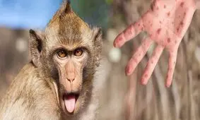 هشدار درباره سویه جدید آبله میمونی