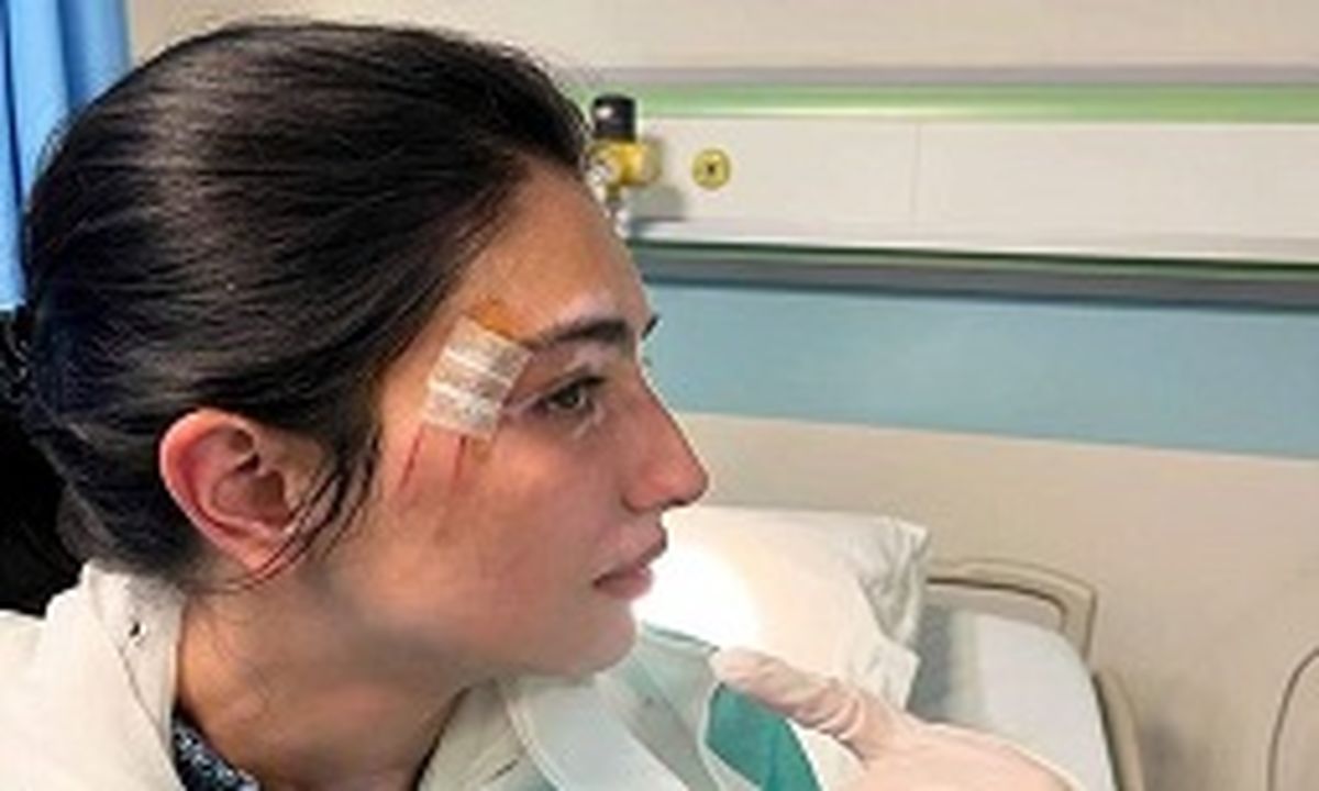 اصابت پهپاد به صورت دختر بینظیر بوتو در پاکستان/ ویدئو