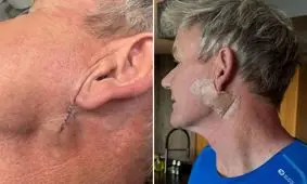 از آشپزخانه تا اتاق عمل؛ جدال سرآشپز جنجالی با سرطان