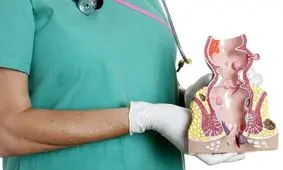 چه کنیم به هموروئید یا بواسیر دچار نشویم