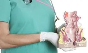 چه کنیم به هموروئید یا بواسیر دچار نشویم
